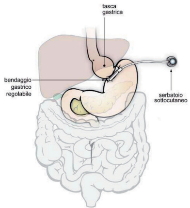 fonte immagine sicob.org 1